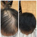 포항에서 온 희망의 빛: 남자탈모, 토탈 탈모 교정 성형펌으로 정면 돌파! 부산사상르네시떼6층미용실 이미지