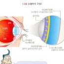 안구건조증 원인 및 , 안구건조증 영양제 이미지