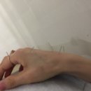 경희동산한의원 네이버블로그