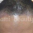 라미헤어 이미지