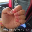 136 | 초뚱땡이 자궁근종수술후기 수술 D-1, 수술당일, 수술후 +4일까지 일상기록