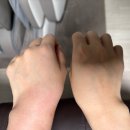 안락샘내과의원 | [익산] 제일탑내과, 수액 맞고 도라에몽 손이 돼..✊🏻 수액 후기