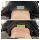 엠케이에너지 | 성북구 피부관리 샵 성신여대 다이어트 엠케이에스테틱 복부 슬리밍 관리