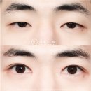 제로원성형외과의원