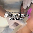 더 오케이 병원 | 춘천 퇴계동 저자극 루미왁싱ㅣ통증 적고 위생 철저한 왁싱샵 솔직후기