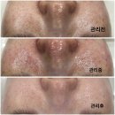한성아카데미주 | “정읍피부관리 어디가 좋을까?” 트라이엄피부관리 직접 받아본 솔직 후기!