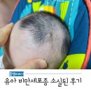 부전어린이집 | 유아 비만세포종 진단~소실 후기