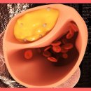 남성반점 이미지