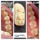 덕치과기공소 이미지