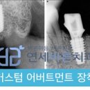 연세바른치과 이미지