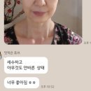 비바 인셀덤