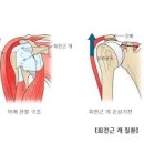 오른쪽 왼쪽 어깨 통증 원인 4가지 이미지