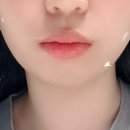 라인비 | 덴탈스 인비져 ( 후기 안찾아보고 인스타 광고보고 산 후기🥹 )