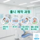 이룸 치과기공소 네이버블로그