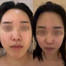 더예쁜날 | 서울시 공공예식 결혼 전 준비 필수! 👰‍♀️ 낙성대 더예쁜날 에스테틱 신부관리 솔직 후기