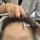 신생모 | 경성대 대연동 두피관리 모앤두피탈모 후기 드디어 신생모!!내돈내산