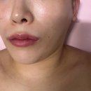 그리미아빌딩 | 정왕동 피부관리 구은희에스테틱 멜라소닉 플라즈마 윤곽 근막 관리 후기+