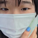 에이치피테크 | [매복사랑니 발치 후기] 아무도 안궁금해하는 사랑니 3개 발치 후 일주일