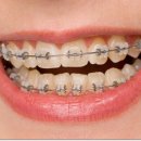 이턱바로치과의원 이미지