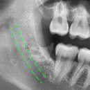 청주으뜸치과의원 이미지