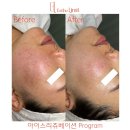 송도피부관리 에스떼리밋 이미지