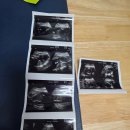 장성병원 | 장성 임산부 꿀팁｜찾아가는 산부인과 무료 초음파 직접 이용해봤어요