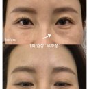 B-뷰티케어