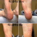 살랑 | 봉천역 살랑블랑왁싱 에스플래닝 후기 서울패디플래닝