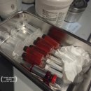 톡스앤필의원 전주점 | 전주 인모드, 레드주사 시술 후기_여름철 예비신부 팔뚝 관리; 지방흡입은 두려운 사람