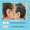 동구보청기 | 대전 동구에서 방문하신 어머님의 보청기 상담 후기