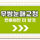 미호성형외과의원 이미지