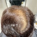 아이민헤어 이미지