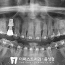 더퍼스트치과의원 음성점 네이버블로그