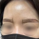 제니의원 | 청담성모의원 눈썹문신 후기｜콤보눈썹으로 붉은기 자연스럽게 커버한 리얼 후기