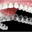 매직치과기공소 이미지