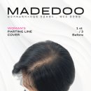 은평-010 | 홍대두피문신, 자연스럽게 커버한 후기
