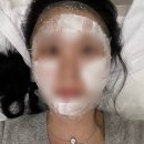 프라임 | 신논현역 근처 피부과 프라임레이즈 후기 효과 가격 유지기간