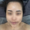초코앤뷰티 | 연산동피부관리 잘하는 벨리브뷰티에서 초코테라피 받은 내돈내산후기