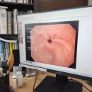 김성준내과의원 | 위장내시경 처음 할때 알아야할 사항 | 동네 의원에서 하고난 후기 | 미국과 한국 병원 차이