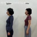 바인드 필라테스 이미지