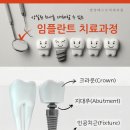 양정베스트치과의원 네이버블로그
