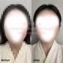 송파 잠실 웨딩관리와 윤곽에 진심인 에스테틱 [조이스킨앤스파] 후기/영업정보