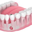 뿌리샘치과의원 이미지