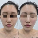 안현로서8길 | 안중에스테틱, 에스왁싱에서 알테온 윤곽관리 받고 온 후기!