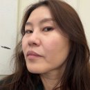 청량리2 | 청량리피부과 티타늄리프팅 시술 효과 통증 만족 리얼 후기