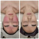 Skin이야기
