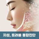 지성안과의원 네이버블로그