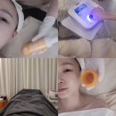 [암사동] 정에스테틱 : 20년경력 시그니처 맞춤 피부관리샵 펌킨필 후기