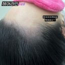 헤어팡팡&가발 이미지