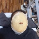 빛나는 | 다시찾은 빛나는 뷰티 내돈내산 후기 (미백관리 리얼체험)